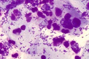 Diplococcusok kenetben férfiakban, Tabularium dermatologiae